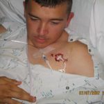 David Clay with catheter in his chest. A computerized IV pump delivered antibiotics every 8 hours.